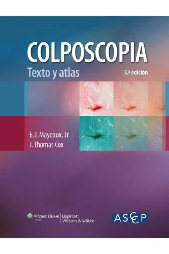 COLPOSCOPIA TEXTO Y ATLAS