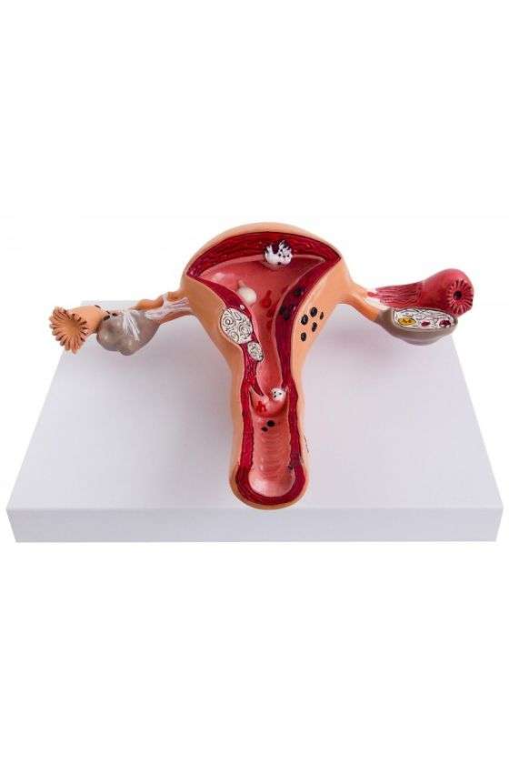 Ovario didactico