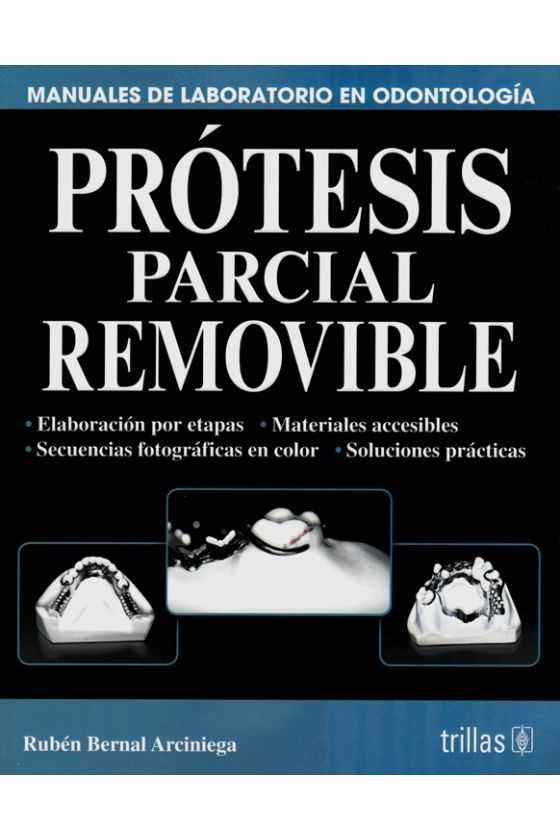 Prótesis Parcial Removible. Bernal